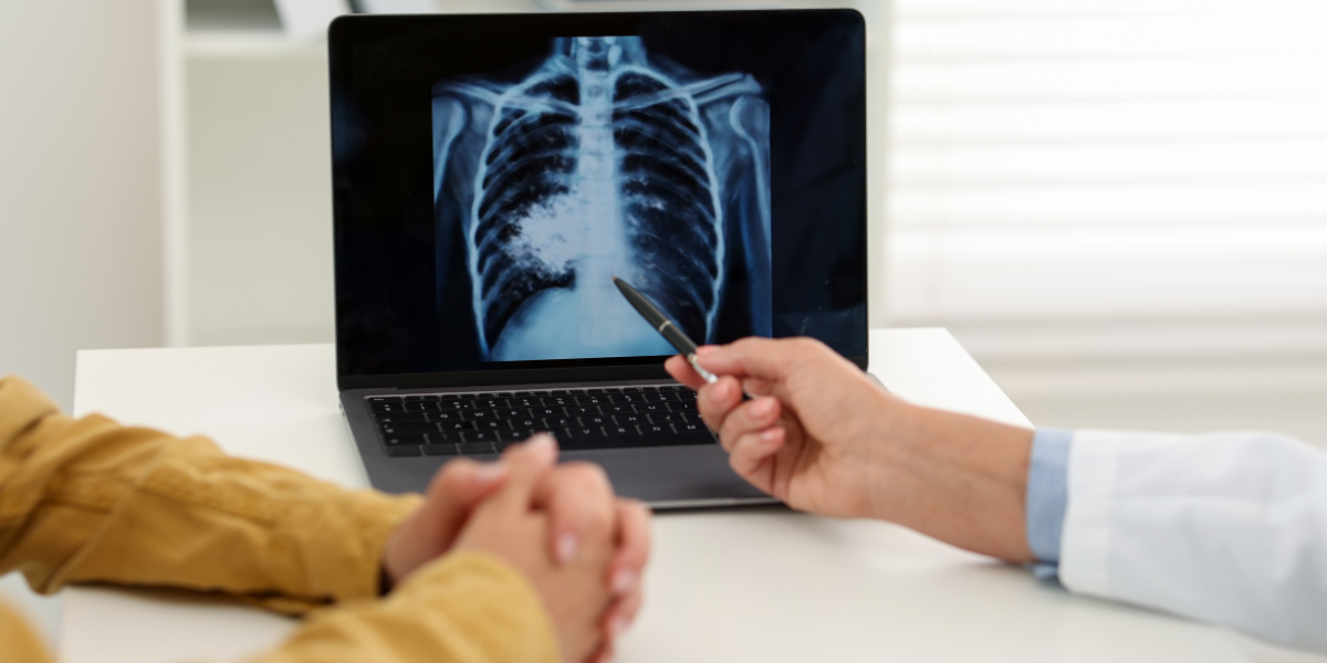 Bridging the Gap: How Financial Incentives and Counselling Improve TB Treatment Outcomes